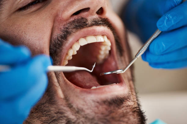 Best Urgent Care for Lost Fillings or Crowns in Clermont, IN